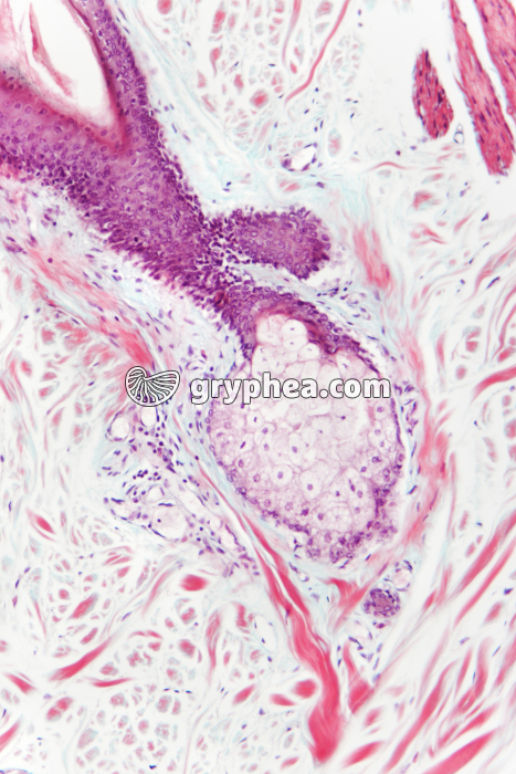 Glande sébacée x 40 - gryphea.org